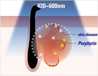 Tecnología Photo Shower de Cellec V