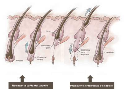 Crecimiento del cabello con CELLMULA HS Solución