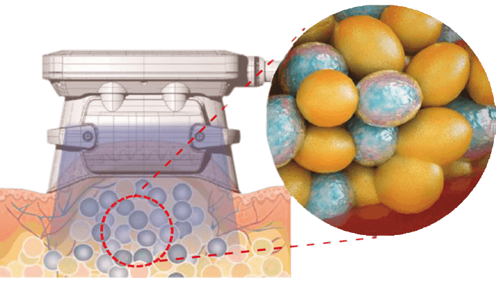 Crío-reaccion con COOLshaping