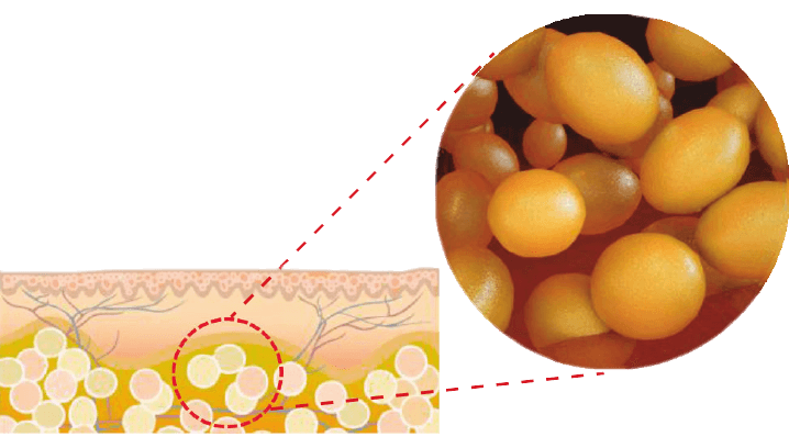 Proceso de celulas eliminadas con COOLshaping