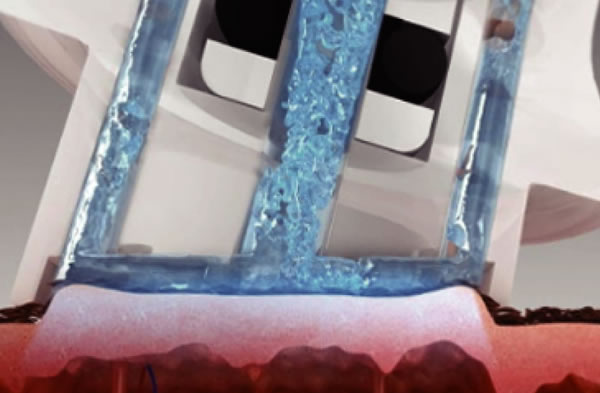 Peeling Hipoalergénico Función