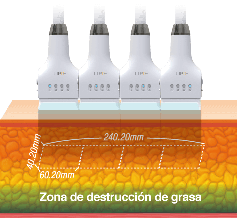 Aplicadores de LIPO1060
