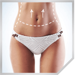 Modelado corporal con LIPOcel