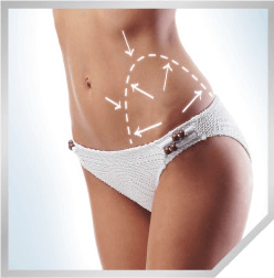 Modelado corporal con LIPOcel