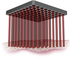 Modo fraccionado de TRI-BEAM Premium