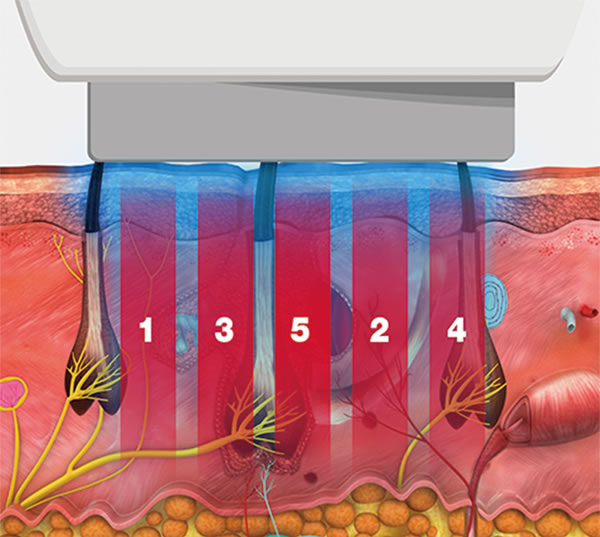 Smart Target Motion de VeLux