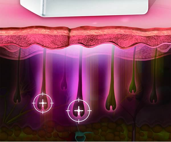 Tecnología de VeLux